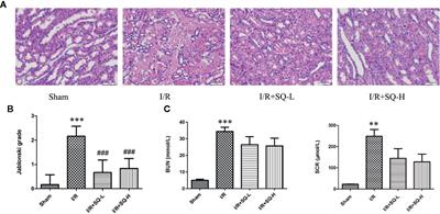 Sanqi Oral Solution Ameliorates Renal Ischemia/Reperfusion Injury via Reducing Apoptosis and Enhancing Autophagy: Involvement of ERK/mTOR Pathways